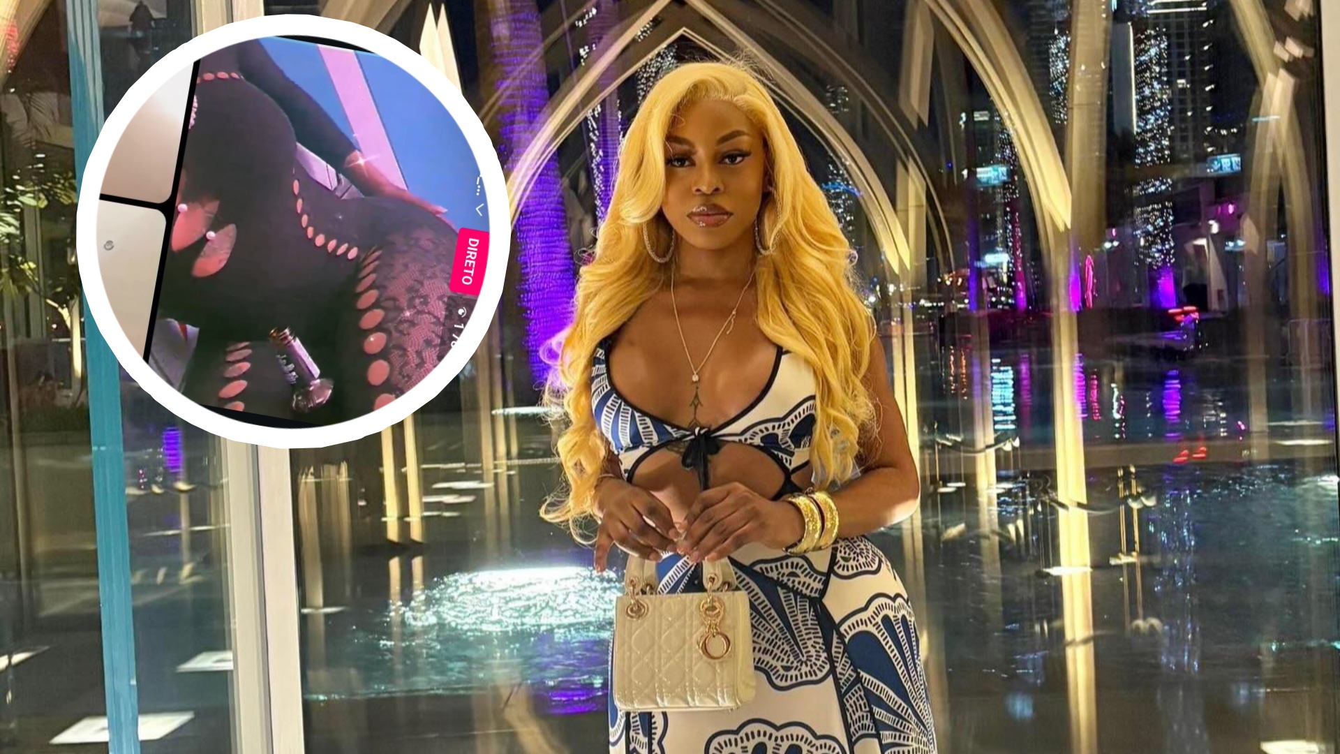 Jessica Lamony mostra resultados de cirurgia na live “minha maçã é muito pequena”